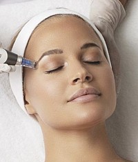 MICRONEEDLING